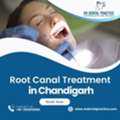 Root Canal Treatment In Chandigarh