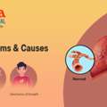 Asthma Explained: Types, Symptoms, Causes & Management Tips