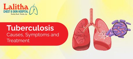 Karimnagar, Health, Tuberculosis Causes, Symptoms & Treatment In Karimnagar