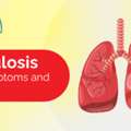 Tuberculosis Causes, Symptoms & Treatment In Karimnagar