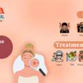 Understanding Acne: Causes, Treatments & Prevention Tips
