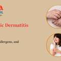 Managing Atopic Dermatitis: Causes, Genetics & Foods To Avoid