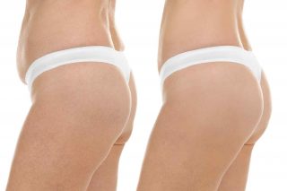 Bangkok, Health & Beauty Items, THB 70000,  Quality Plastic Surgery Thailand & Cosmetic Surgery Thailand With Lotus Medical Internatio