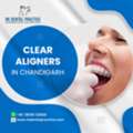Clear Aligners In Chandigarh For A Confident Smile