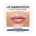 Get Fuller, Softer Lips With Expert Lip Augmentation!
