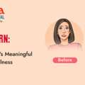 Effective Melasma Treatment | Hello Radiant Skin