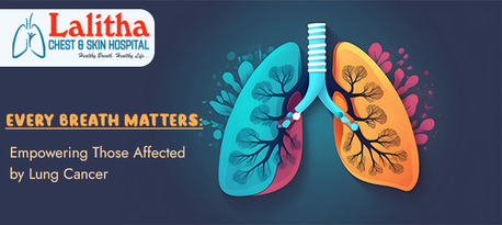 Karimnagar, Health, Lung Cancer Symptoms, Types & Treatment Options