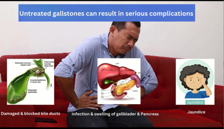 Bangalore, Health, Gall Stones & Gallbladder Disorder Treatment - Dr. Praveen MP, Bangalore
