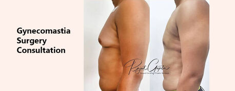 Mumbai, Health, Gynecomastia Surgery Consultation Online &ndash; How To Prepare