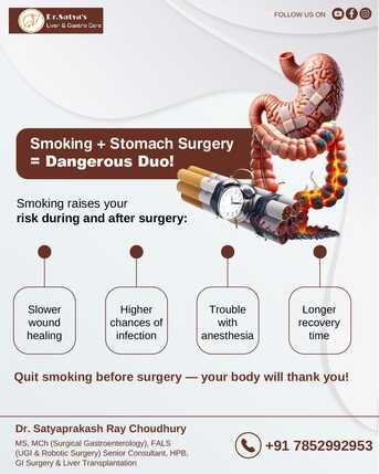 Mumbai, Health, Smoking & Stomach Surgery | Dr. Satyaprakash Ray Choudhury