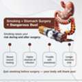 Smoking & Stomach Surgery | Dr. Satyaprakash Ray Choudhury