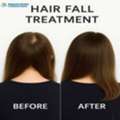 Hair Loss Treatment In Noida &ndash; Herbal Hair Care Experts