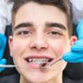 Expert Orthodontics Doctor In New Hyde Park For Braces And Clear Aligners