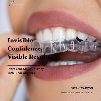 New York, Dental, Smilers Clear Aligners &ndash; Modern Orthodontics For Modern Smiles