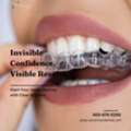 Smilers Clear Aligners &ndash; Modern Orthodontics For Modern Smiles
