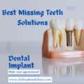 Best Dental Clinic In Trivandrum