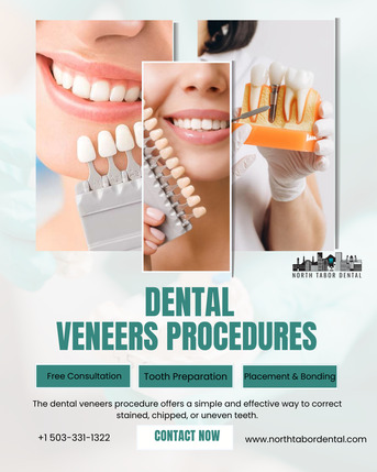 San Francisco, Health, Are Denture Veneers Permanent Or Removable?