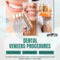 Are Denture Veneers Permanent Or Removable?