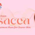 Rosacea Explained: Best Treatment Strategies For Clearer Skin