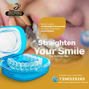 Hyderabad, Dental, Invisalign In Secunderabad At Smile Dental And Implant Centre