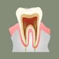 Affordable & Advanced Root Canal Treatment In Kolkata