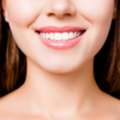 Jaw Augmentation Surgery For Stronger Profile