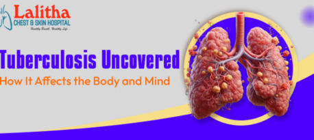 Karimnagar, Health, The Dual Impact Of Tuberculosis: Effects On Body And Mind