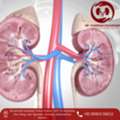 Best Kidney Stone Treatment In Mumbai &ndash; Dr. Chandan Chaudhari