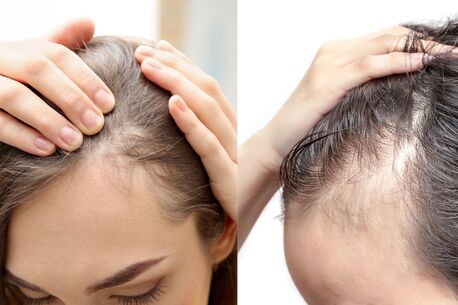 Mumbai, Health, Advanced Hair Transplant Solutions In Thane At DNA Royal Clinic