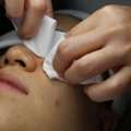 Reliable Facial With Extraction Singapore By Mirage Aesthetic