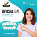 Top Rated Invisalign Near Me | Smile Dental Hyderabad Reviews