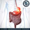 Get The Best Stomach Cancer Treatment In Mumbai - Dr. Shankar Zanwar