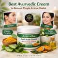 Best Ayurvedic Cream To Remove Pimple & Acne Marks