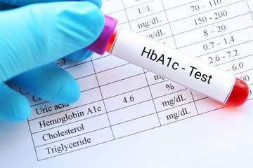 Mumbai, Health, HbA1C Blood Test At Home