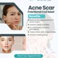 Clear Acne-Free Skin Starts Here In Secunderabad