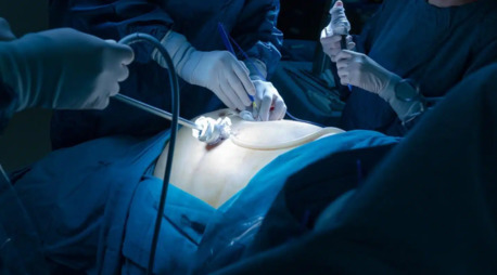 New Delhi, Health, Top Laparoscopic Urology Surgeon In Delhi & Max Hospital Expert