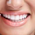 Best Dental Clinic In Brooklyn For Gentle, Affordable, Family Dental Care Services