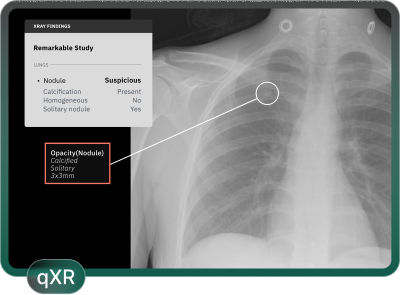 New York, Medical, Qure.ai | Advanced AI Solutions In Healthcare Imaging