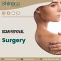 Shinora Clinic &ndash; Best Scar Removal Surgery In Ahmedabad For Smooth Skin