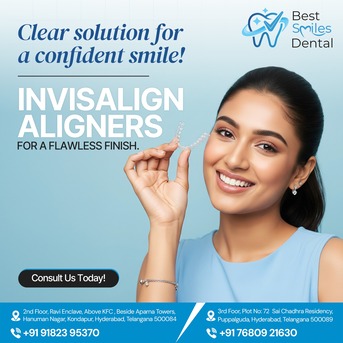 Hyderabad, Dental, Invisalign Aligners In Hyderabad - Best Smiles Dental