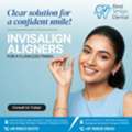 Invisalign Aligners In Hyderabad - Best Smiles Dental