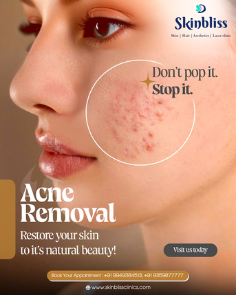 Hyderabad, Health, Acne Scar Treatment In Jubilee Hills : Skin Bliss