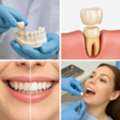 Dental Crowns: Restore Your Smile With Confidence