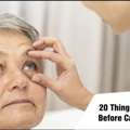 20 Things I Wish I Knew Before Cataract Surgery In 2025 - Skipper EyeQ