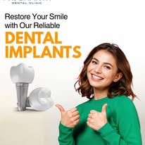 Bangalore, Dental, Dental Implants In Vijayanagar