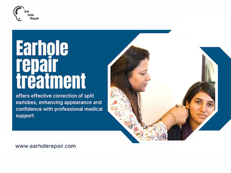 Coimbatore, Business, A Simple Solution For Torn And Split Earlobes