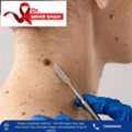 Highly Experienced Head And Neck Cancer Surgeon In Ahmedabad Dr Mihir Shah