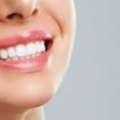 How Scaling And Polishing Help Prevent Gum Disease?