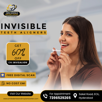 Hyderabad, Dental, Invisalign Clear Aligners In Hyderabad &ndash; A Smarter Way To Straighten Your Smile