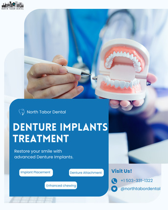 San Diego, Dental, Choosing The Best Denture Implants Treatment Center Near You !